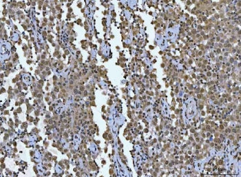 TCF-8 Antibody / ZEB1 / AREB6