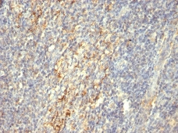 Transglutaminase 2 Antibody