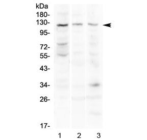 Western blot testing of 1) human COLO320, 2) mouse pancreas and 3) mouse lung lysate with TLR3 antib