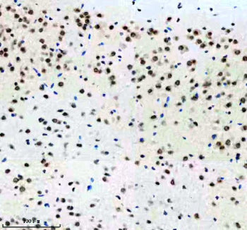 IHC staining of FFPE mouse brain tissue with p73 antibody, HRP-labeled secondary and DAB substrate. 