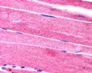 IHC testing of FFPE human skeletal muscle with SORBS1 antibody at 2.5ug/ml. HIER: steamed with pH6 c