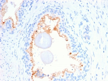 CD10 Antibody / Neprilysin