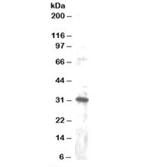 Western blot testing of Jurkat lysate with DKK4 antibody at 1ug/ml. Detection of the 30-32kDa form o