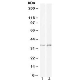 Western blot testing of 1) human cerebellum and 2) rat brain lysate with DLX2 antibody at 1ug/ml. Pr