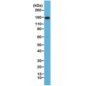 Western blot testing of human Jurkat cell lysate with recombinant ITGA4 antibody at 1:1000. Predicte