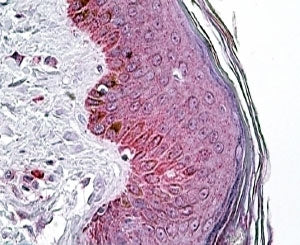 IHC staining of FFPE human skin with PNPLA3 antibody at 4ug/ml. HIER: steamed with pH6 citrate buffe