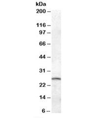 PSPH Antibody