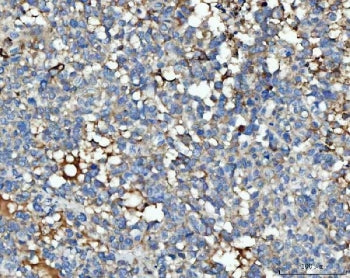 THBS3 Antibody / Thrombospondin-3