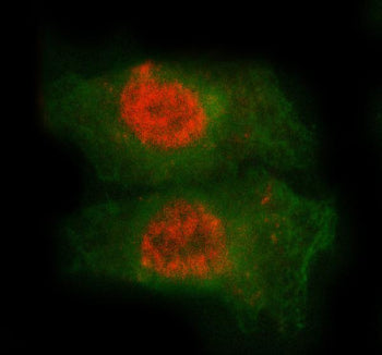 Immunofluorescent staining of FFPE human A549 cells with MED7 antibody (red) and Beta Tubulin mAb (g