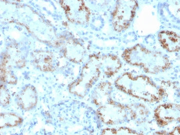 Retinol Binding Protein 4 Antibody / RBP4