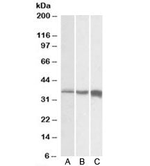 Western blot testing of A) human, B) mouse and C) rat skeletal muscle lysates with TNNT3 antibody at