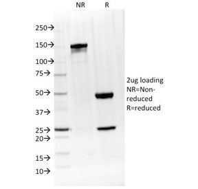 SDS-PAGE analysis of purified, BSA-free Interleukin 4 antibody (clone IL4/1597) as confirmation of i