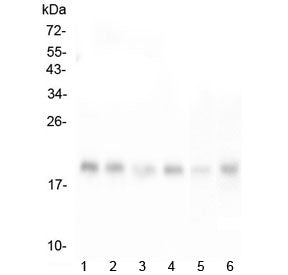 Western blot testing of human 1) HeLa, 2) T-47D, 3) HepG2, 4) K562, 5) mouse liver and 6) mouse HEPA
