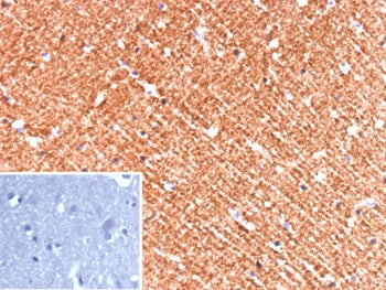 IHC staining of FFPE human brain tissue with Hexokinase 1 antibody (clone HK1/9510). Inset: PBS used
