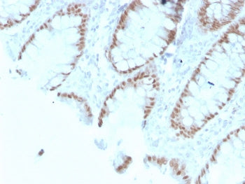 IHC testing of FFPE human colon with recombinant CDX2 antibody (clone rCDX2/1690). HIER: boil tissue