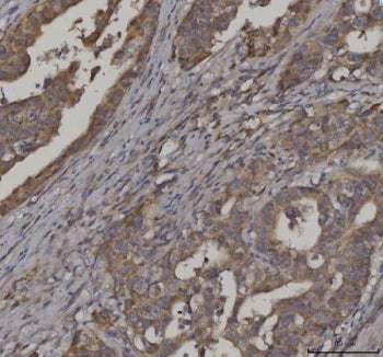 FATP-3 Antibody / ACSVL3 / SLC27A3