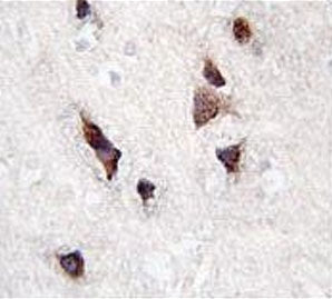 CSEN Antibody / Calsenilin / KCNIP3