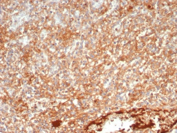 IHC staining of FFPE human spleen tissue with PTPN6 antibody (clone PTPN6/7543). HIER: boil tissue s