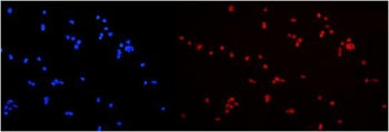 Immunofluorescent staining of FFPE human U-2 OS cells with HNRNPA2B1 antibody (red) at 2ug/ml and DA