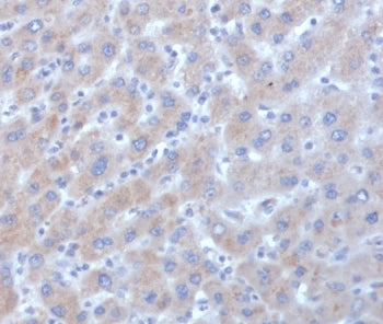 IHC staining of FFPE human liver tissue with Alpha-1-Antichymotrypsin antibody (clone SERPINA3/4185). HIER: boil tissue sections in pH 9 10mM Tris with 1mM EDTA for 20 min and allow to cool before testing.