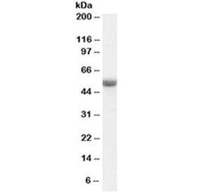 Western blot testing of human ovay lysate with TRAF2 antibody at 0.1ug/ml. Predicted molecular weigh