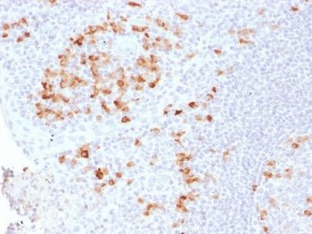 IHC testing of FFPE human tonsil tissue with recombinant Kappa antibody (clone KLC2289R). Required H