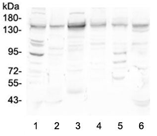 Western blot testing of human 1) HeLa, 2) placenta, 3) ThP-1, 4) K562, 5) PC-3 and 6) Caco-2 lysate 