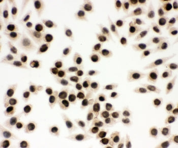 ICC staining of FFPE human SMMC-7721 cells with EWSR1 antibody at 1ug/ml. HIER: Boil the paraffin se