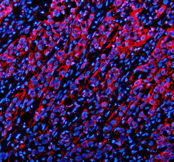 Immunofluorescent staining of TWSG1 using anti-TWSG1 antibody (red). TWSG1 was detected in a paraffi