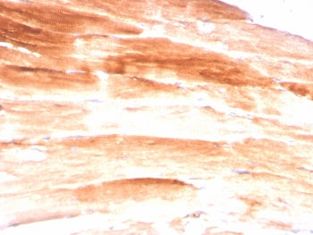 IHC staining of FFPE skeletal muscle with Dystrophin antibody (clone DMD/3245). HIER: boil tissue se