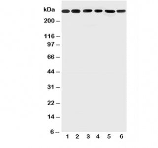 Western blot testing of Mucin-5AC antibody and Lane 1: SGC; 2: HeLa; 3: COLO320; 4: SW620; 5: MCF-7;