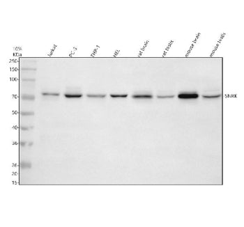 Western blot analysis of SNRK using anti-SNRK antibody. Electrophoresis was performed on a 10% SDS-P