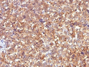 Alpha Fetoprotein / AFP Antibody