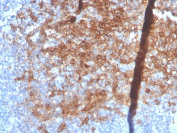 IHC staining of FFPE human small intestine with recombinant Syndecan-1 antibody (clone SDC1/4378R). 
