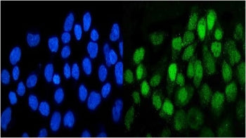 Immunofluorescent co-staining of human A431 cells with DDR1 antibody (green) and DAPI nuclear stain 