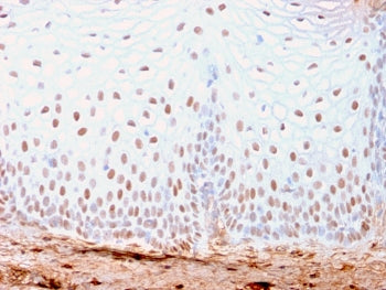 IHC staining of FFPE human skin with recombinant SOX2 antibody (clone SOX2/3169R). HIER: boil tissue