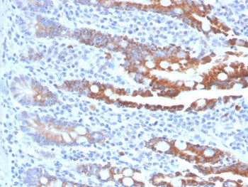 CEACAM1 Antibody / BGP-1