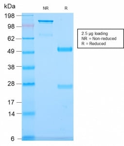 SDS-PAGE analysis of purified, BSA-free CD79b antibody (clone IGB/2940R) as confirmation of integrit