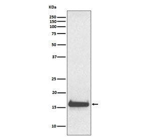 Western blot testing of human serum lysate with Transthyretin antibody. Predicted molecular weight ~