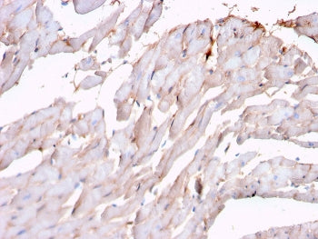 IHC staining of FFPE human heart with recombinant N-Cadherin antibody (clone rCDH2/1426). HIER: boil