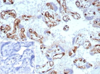 IHC staining of FFPE human placental tissue with FABP4 antibody (clone rFABP4/8536) at 2ug/ml. Inset