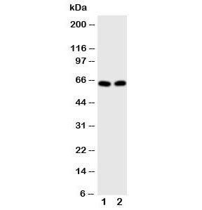 Western blot testing of E2F1 antibody and Lane 1: HeLa; 2: MCF-7 cell lysate. Predicted molecular we