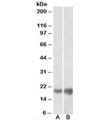Western blot testing of HEK293 [A] and HeLa [B] lysates with DUT antibody at 0.1ug/ml. Predicted mol