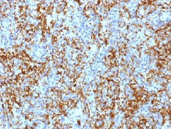 IHC testing of FFPE human spleen tissue with Integrin beta 3 antibody (clone ITGB3/1713). Required H