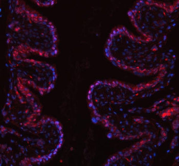 Immunofluorescent staining of FFPE mouse bladder tissue with PUS7 antibody (red) and DAPI nuclear st