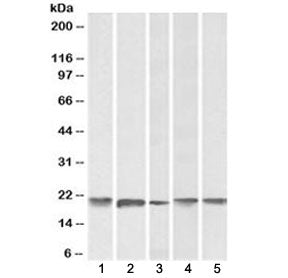 Western blot testing of human 1) cerebellum, 2) liver, 3) placenta, 4) mouse brain and 5) rat brain 