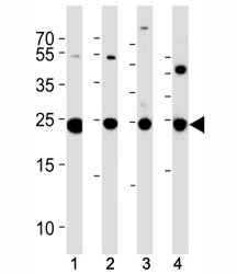 PGP 9.5 antibody western blot analysis in (1) U266, (2) NCI-H1299, (3) mouse Neuro-2a cell line and 