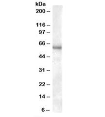 Western blot testing of human kidney lysate with P2RX4 antibody at 0.3ug/ml. Expected molecular weig