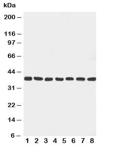 MEK6 Antibody (MKK6)