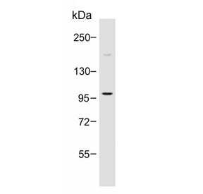 PI3KCD Antibody / PI3K delta / p110 delta